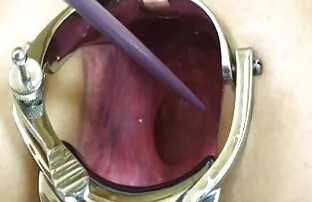 XXX 118-åriga foto strök med hennes svensk gratis porrfilm röda skivor